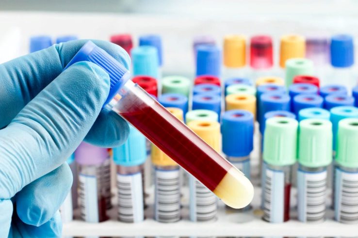 анализы на гормоны щитовидной железы