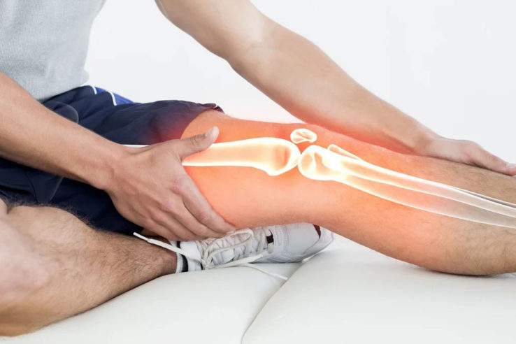 посттравматический артроз