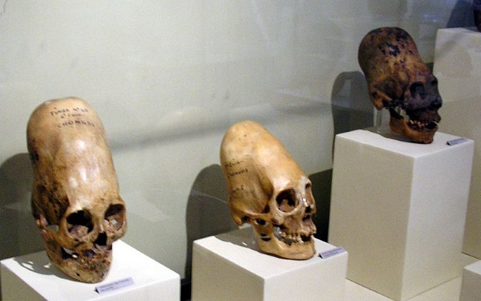 10 исторических примеров деформации черепов древними людьми