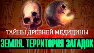 Тайны древней медицины — Земля. Территория загадок (документальные фильмы)