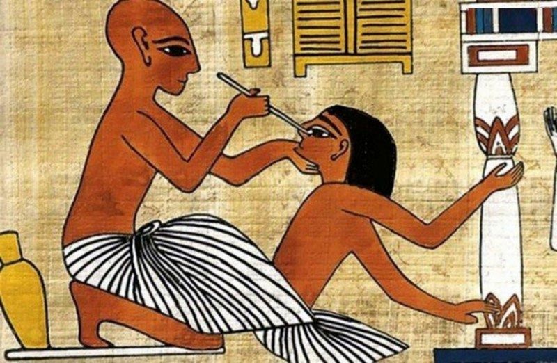 факты о Древнем Египте медицина